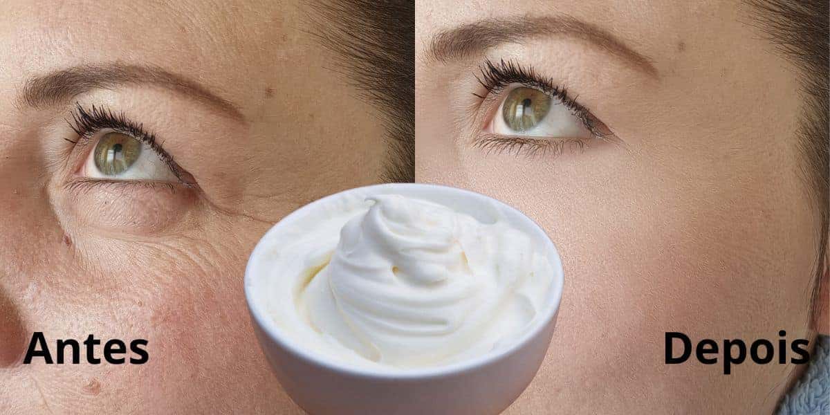 Fim das rugas com receita caseira e creme de leite (Reprodução: Montagem TV Foco)