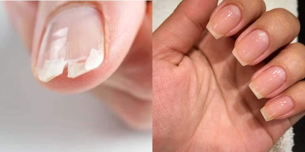 Apenas 6 passos ressucitam o brilho e deixam as unhas indestrutíveis - (Foto: Montagem / TV FOCO)