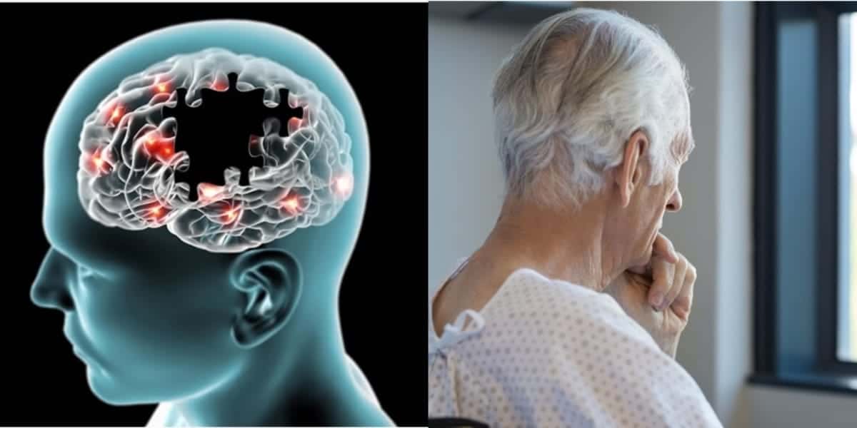 Alzheimer (Foto Reprodução/Montagem/Tv Foco)