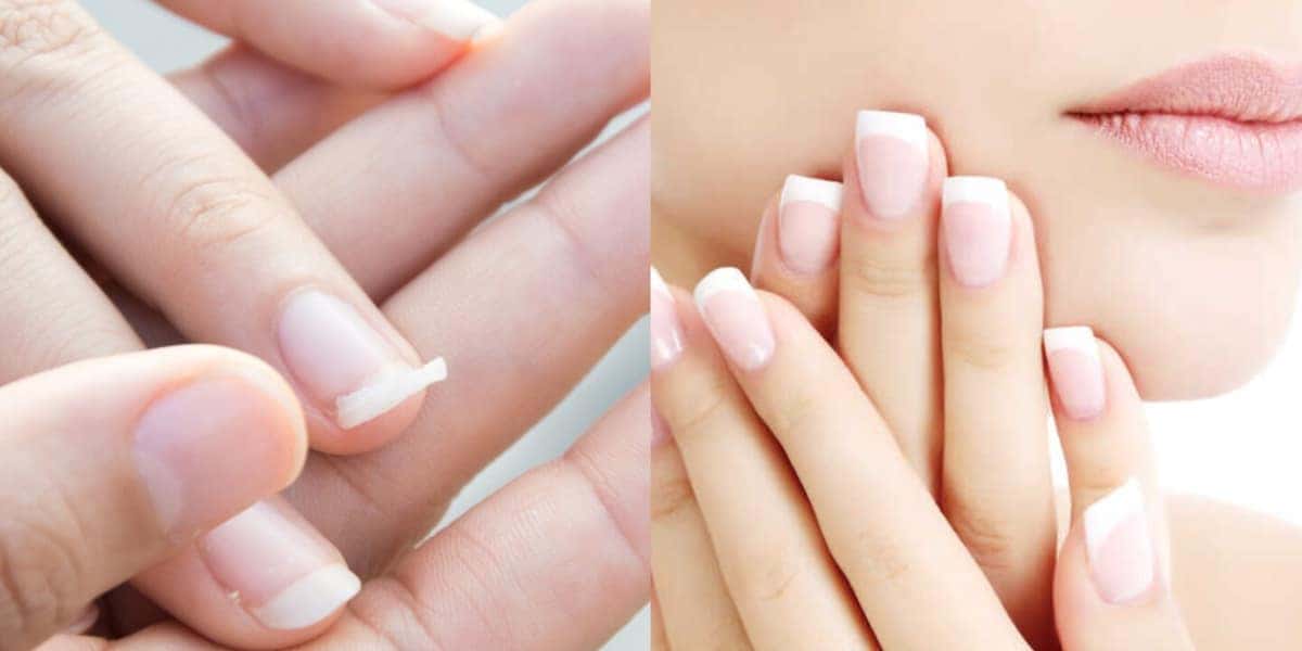 Como fortalecer as unhas em poucos minutos (Foto: Reprodução/ Internet)