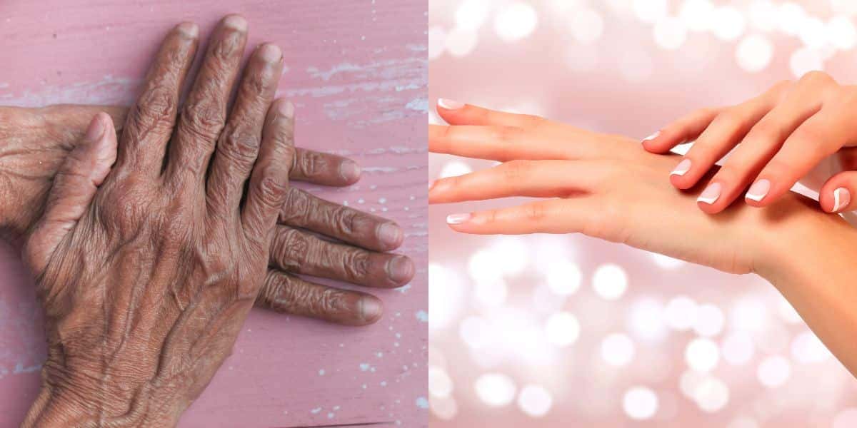 Dê adeus as rugas nas mãos com 2 receitas caseiras (Reprodução: Montagem TV Foco)