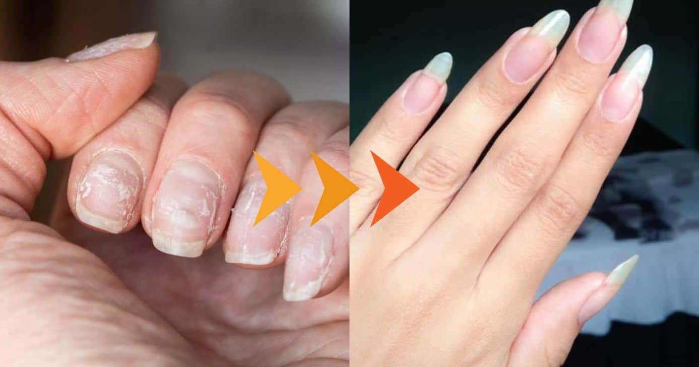 Unhas - Montagem: TVFOCO