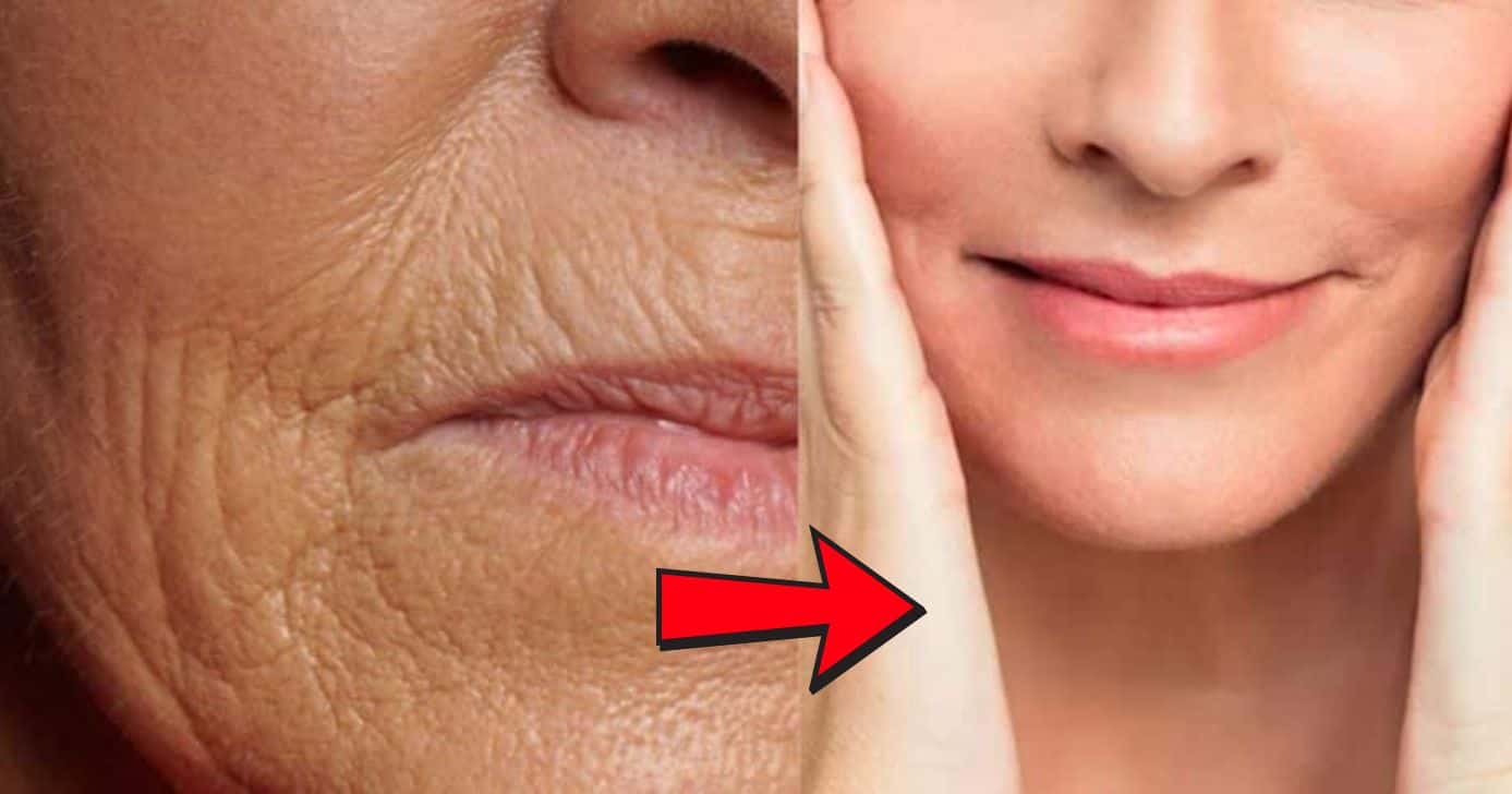 Antes e depois - Montagem: TVFOCO