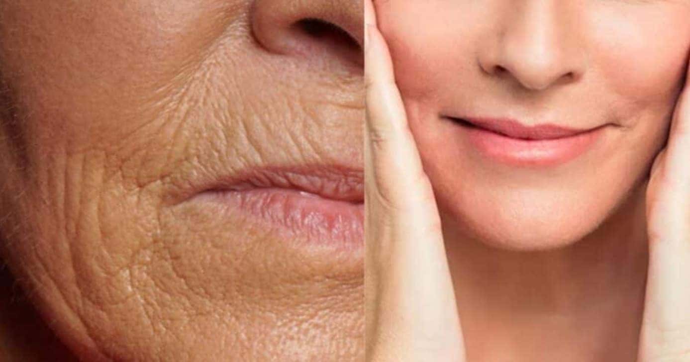 Receita com 1 ingredientes apaga rugas, manchas e traz pele de seda como mágica - Foto: Internet