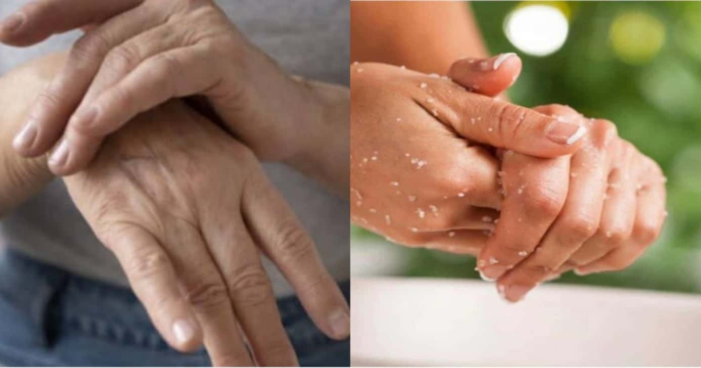 Mãos 25 anos mais jovens: Esfoliante natural acaba com calos (Foto: Reprodução/ Internet)