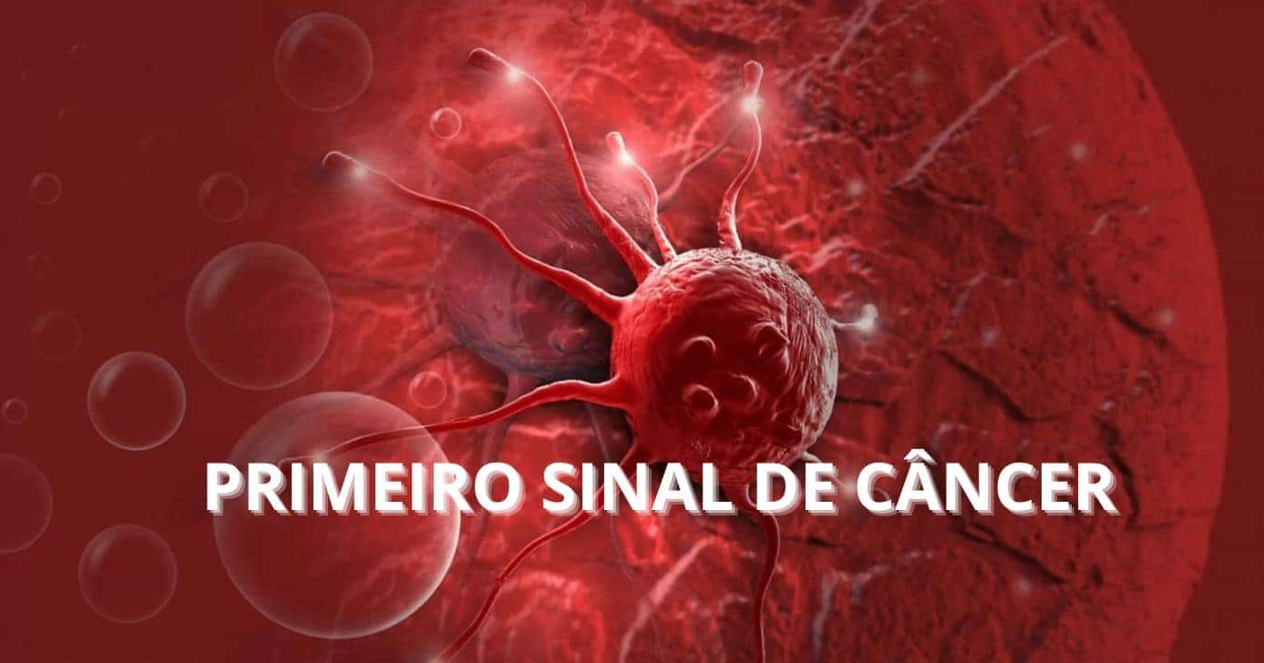 Câncer - Foto Internet