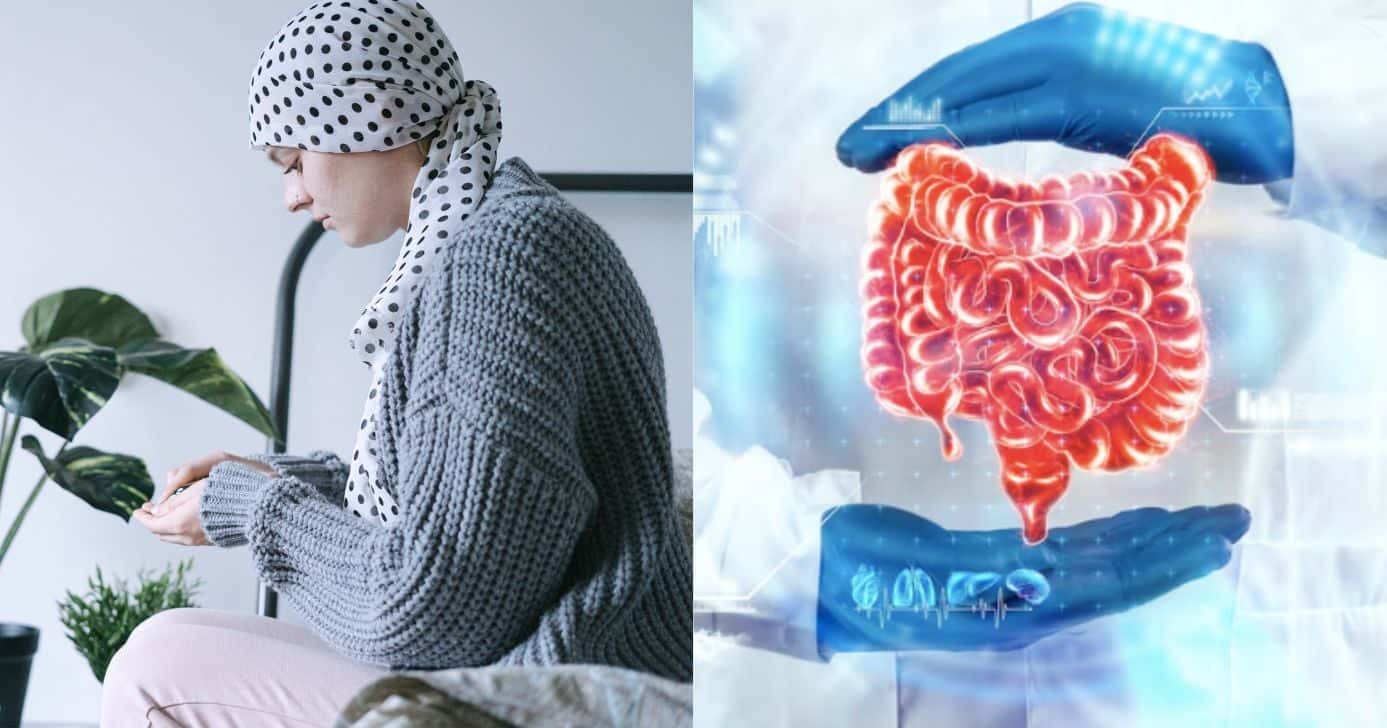 Ilustração câncer e problemas no intestino (Fotos: Canva / Freepik)