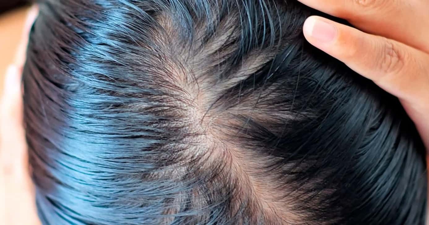 O fim do cabelo oleoso (Foto: Divulgação)