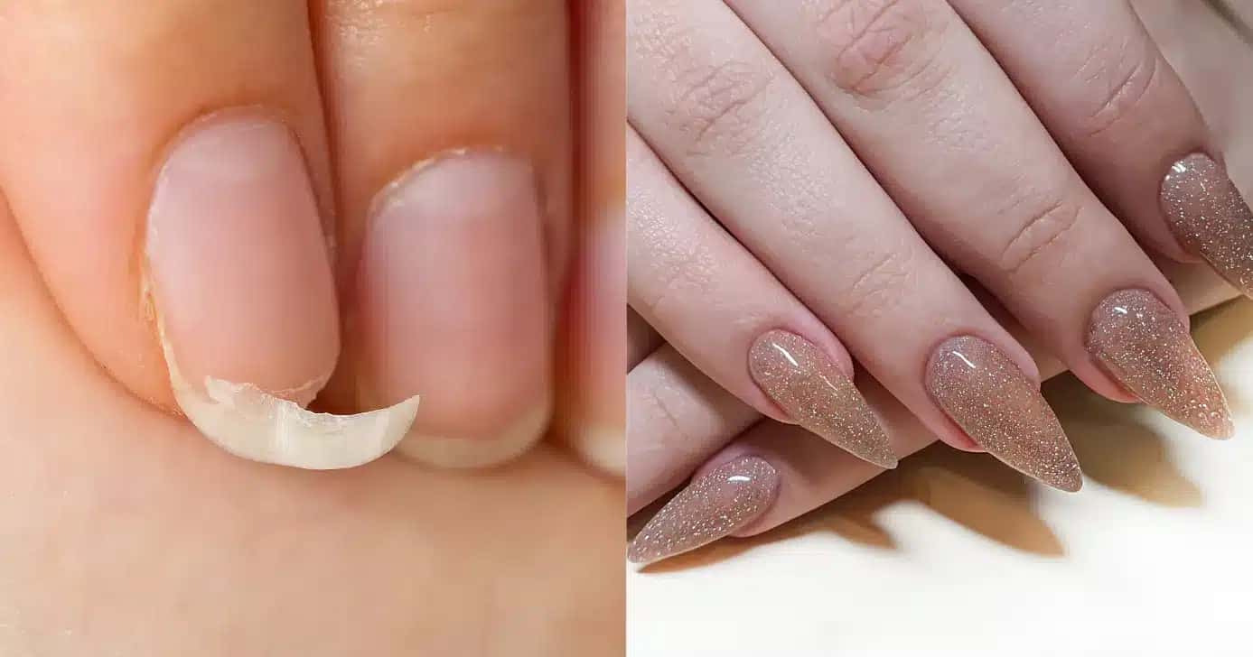 Antes e depois de unhas fracas (Foto: Canva)