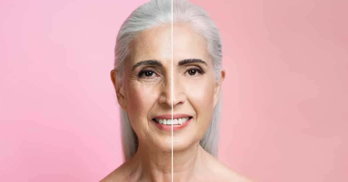 Ilustração antes e depois de rugas (Foto: Freepik)