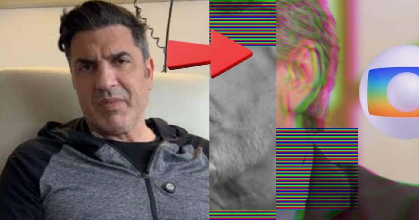 Astro global sofreu do mesmo câncer de Edu Guedes e vive assim hoje (Foto: Reprodução/ Instagram/ Globo/ Montagem)