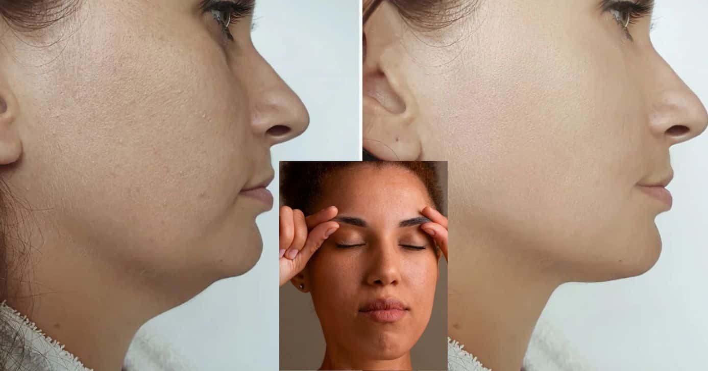 Como fazer massagem mágica que acaba com o inchaço do rosto ao acordar (Foto Reprodução/Montagem/TV Foco/Canva/Paola)