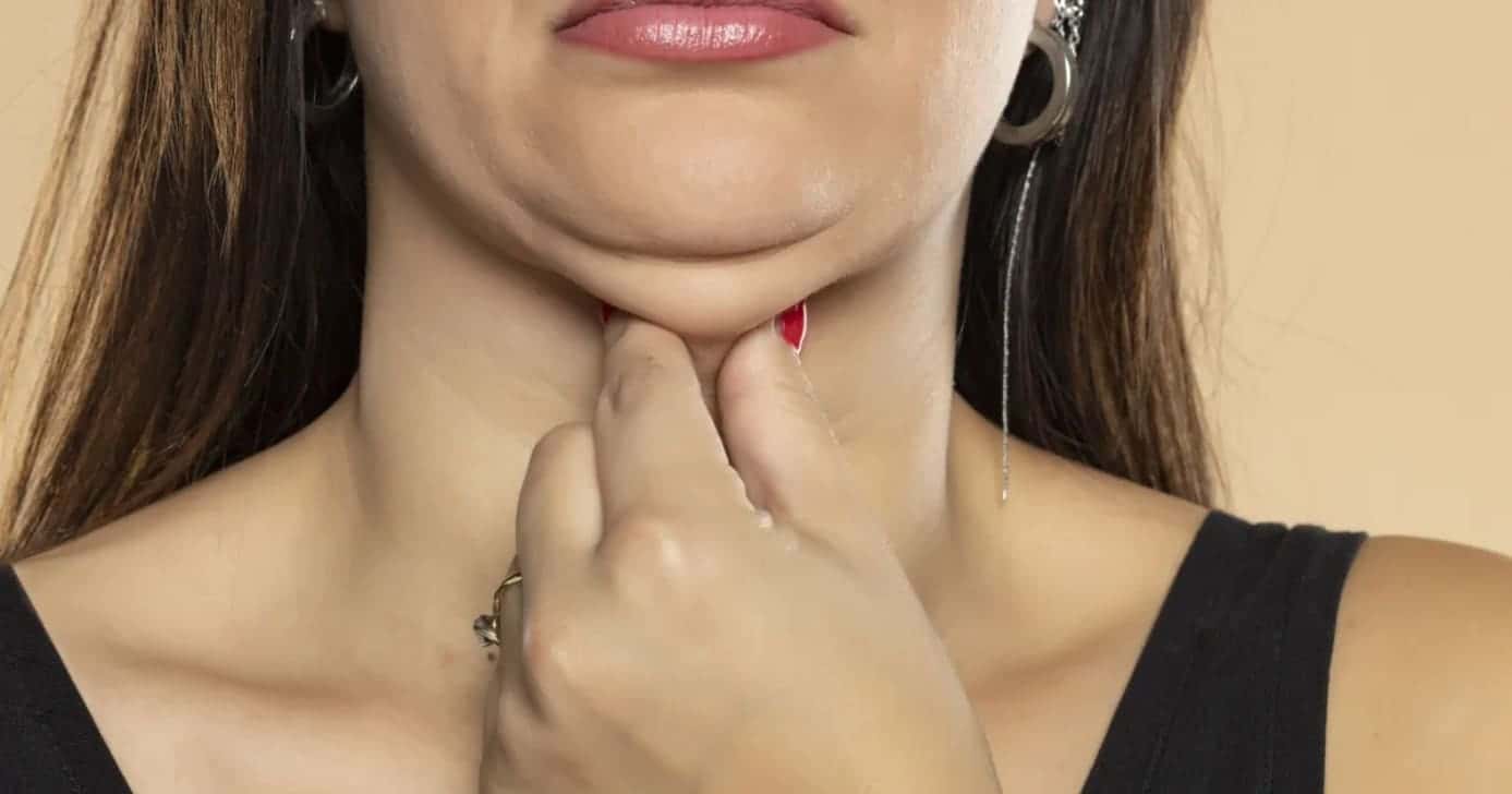 Como eliminar papada (Foto: Divulgação)