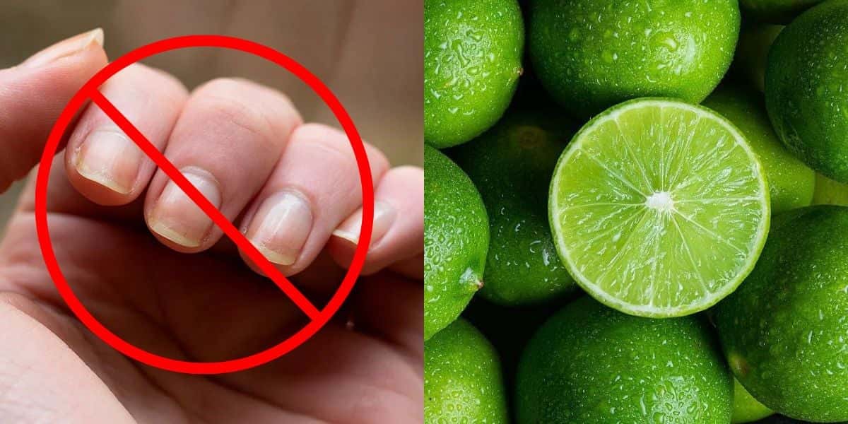 Fim das unhas amareladas com limão (Reprodução: Montagem TV Foco)