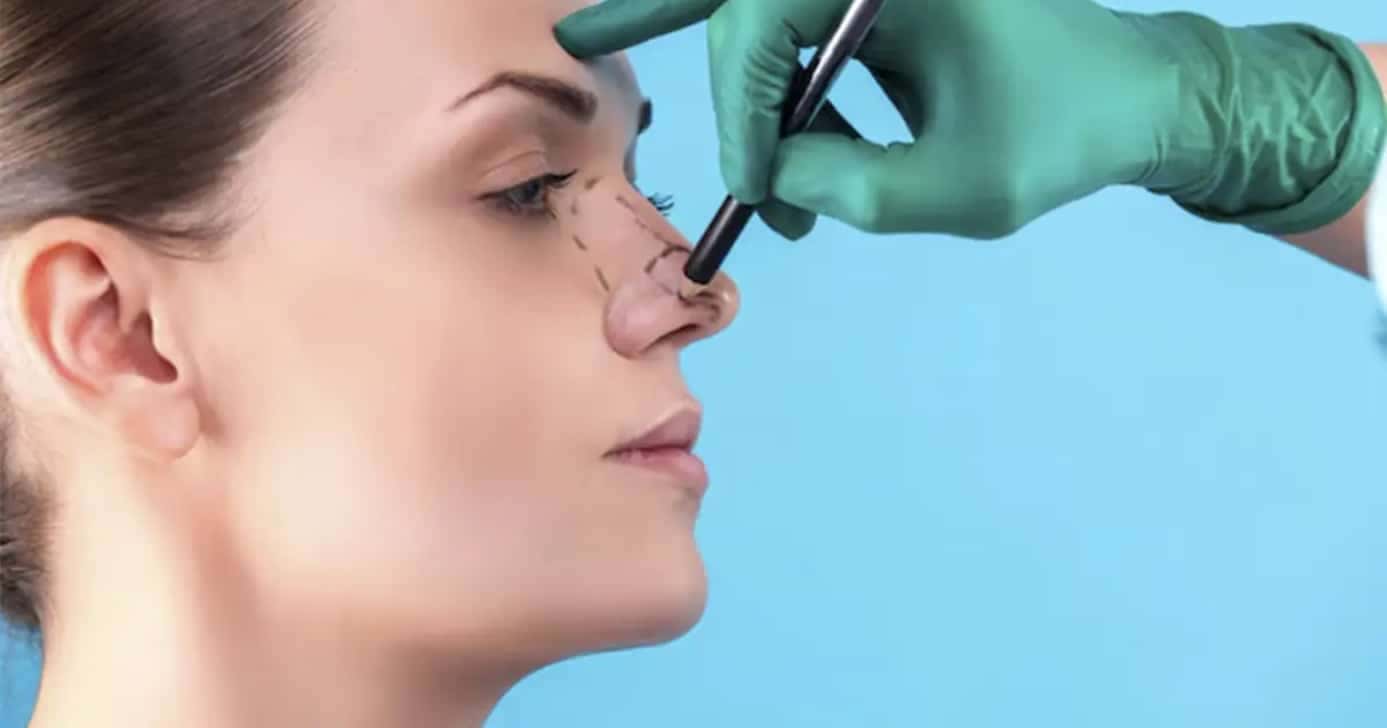 Rinoplastica caseira com esse truque (Foto: Divulgação)