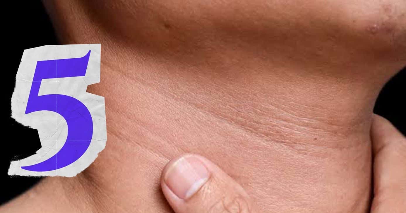 Rugas no pescoço: Dermatologista informa 5 dicas práticas para reduzir (Foto Reprodução/Montagem/TV Foco/Canva/Paola)