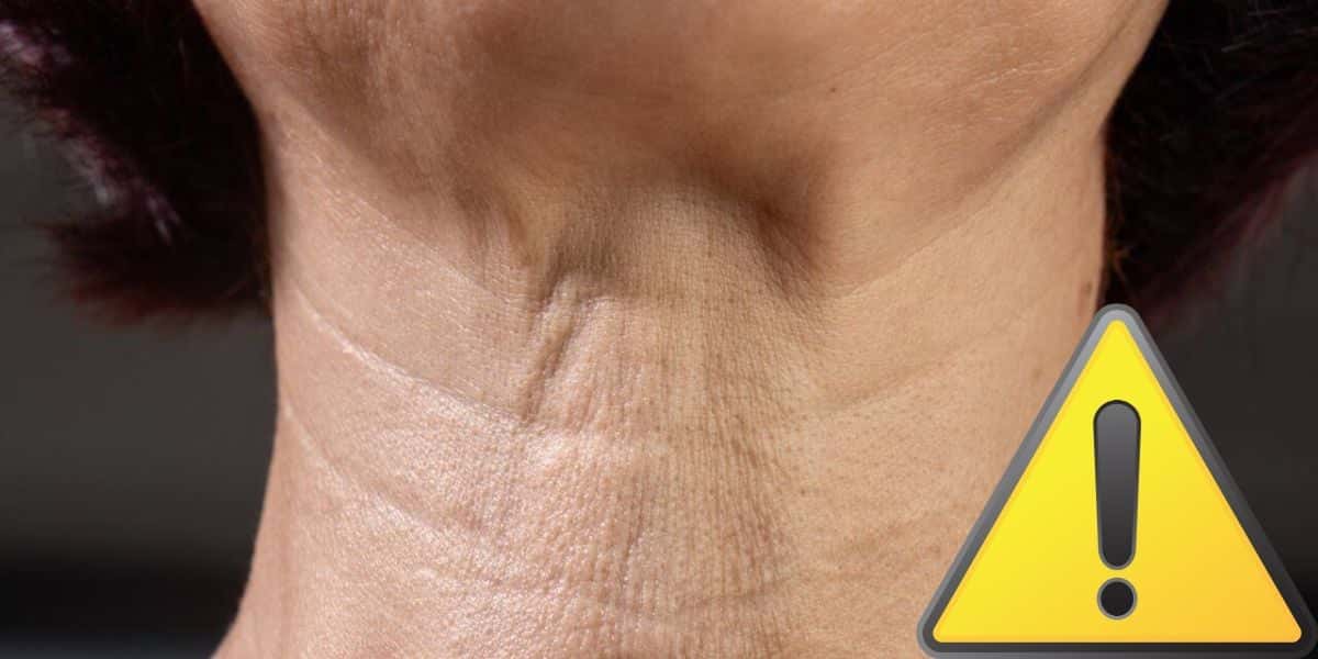 Dermatologista com 5 dicas para reduzir as rugas no pescoço (Reprodução: Montagem TV Foco)