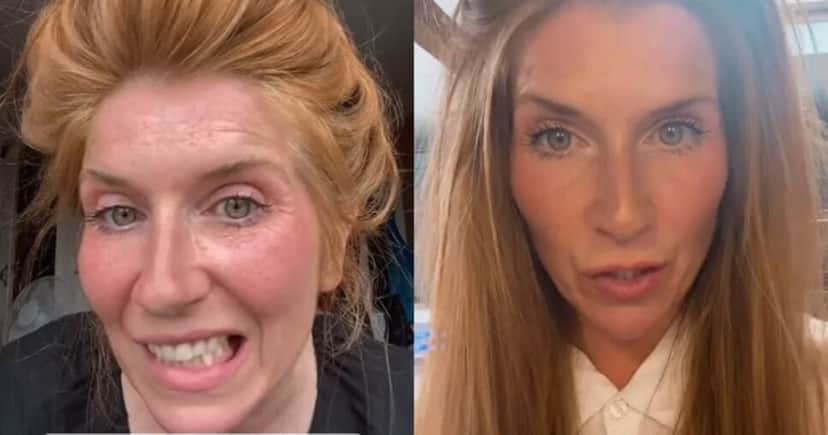 Antes e depois de Kate Antes e depois de Kate