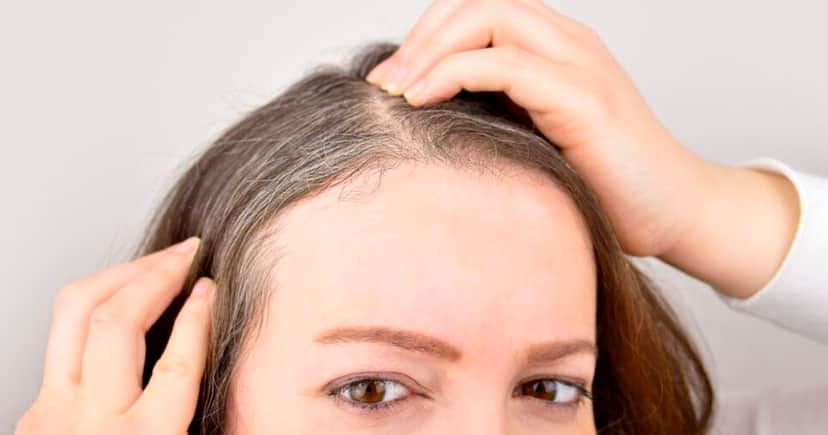 Cabelo branco (Foto: Reprodução) Cabelo branco (Foto: Reprodução)