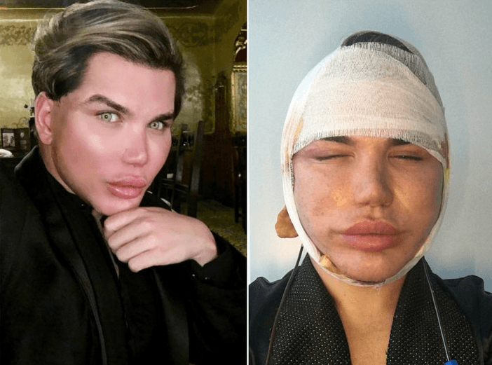 Ken, e Rodrigo Alves Foto: Reprodução Ken, e Rodrigo Alves Foto: Reprodução