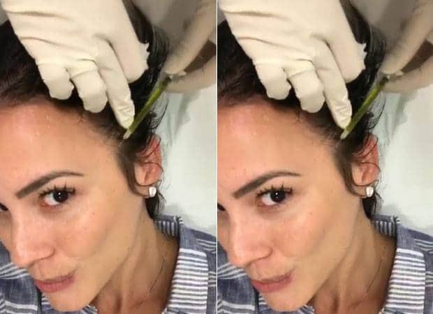 Juliana Knust faz tratamento para queda de cabelo assim como Ana Furtado (Foto reprodução) Juliana Knust faz tratamento para queda de cabelo assim como Ana Furtado (Foto reprodução)