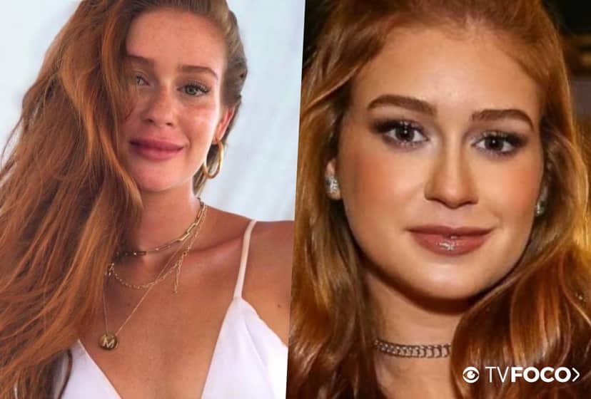 Marina Ruy Barbosa fez ou não procedimento nos lábios Marina Ruy Barbosa fez ou não procedimento nos lábios