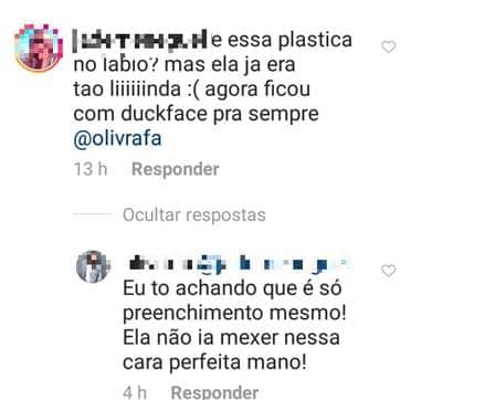 Marina Ruy Barbosa teria feito procedimento Marina Ruy Barbosa teria feito procedimento