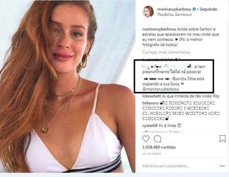Marina Ruy Barbosa teria feito procedimento Marina Ruy Barbosa teria feito procedimento