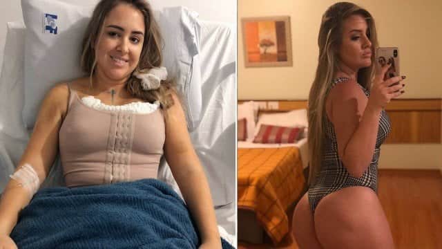 Patrícia, do BBB18, fez lipoescutura, colocou silicone nos seios e injetou gordura no bumbum (Foto: Reprodução/Instagram) Patrícia, do BBB18, fez lipoescutura, colocou silicone nos seios e injetou gordura no bumbum (Foto: Reprodução/Instagram)