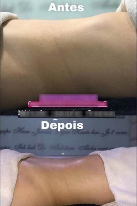Blog post image
