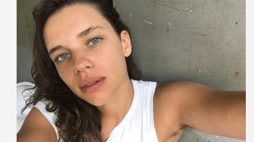 Bruna Linzmeye, da Rede Globo, e sua opção em não depilar (Foto: Reprodução/Instagram) Bruna Linzmeye, da Rede Globo, e sua opção em não depilar (Foto: Reprodução/Instagram)