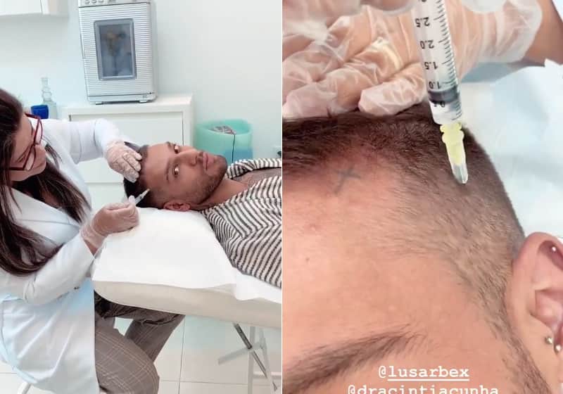 Lucas Lucco faz tratamento contra calvície (Foto: Divulgação) Lucas Lucco faz tratamento contra calvície (Foto: Divulgação)