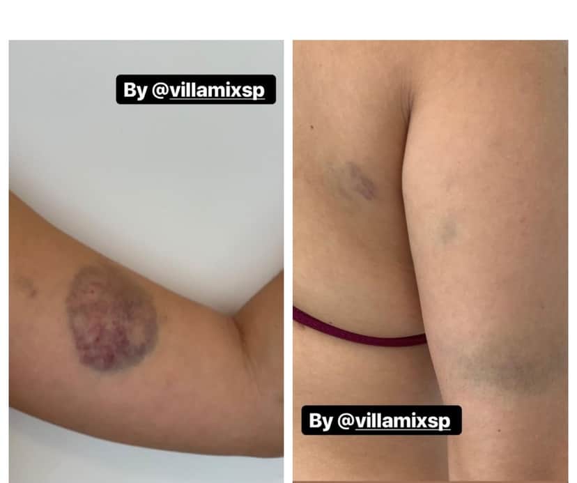 Após espancamento e caso de racismo, Jorge e Mateus publica nota de repudio e abandona o Villa Mix Foto: Reprodução Após espancamento e caso de racismo, Jorge e Mateus publica nota de repudio e abandona o Villa Mix Foto: Reprodução