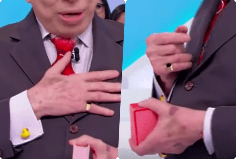 Marcas roxas nas regiões das mãos de Silvio Santos estão chamando a atenção no SBT Marcas roxas nas regiões das mãos de Silvio Santos estão chamando a atenção no SBT