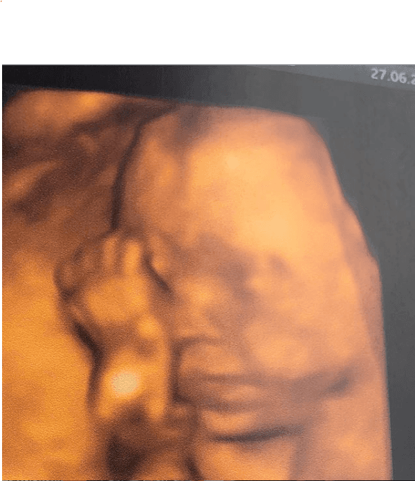 Ultrassom da filha de Tatá Werneck e Rafael Vitti (Foto: Reprodução/ Instagram)