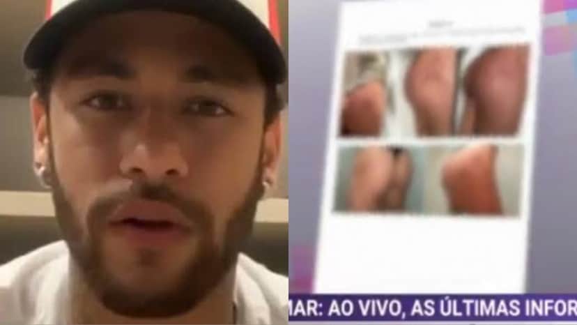 Vazam imagens de hematomas de supost vítima de Neymar após agressão (Imagens: Montagem/TV Foco) Vazam imagens de hematomas de supost vítima de Neymar após agressão (Imagens: Montagem/TV Foco)