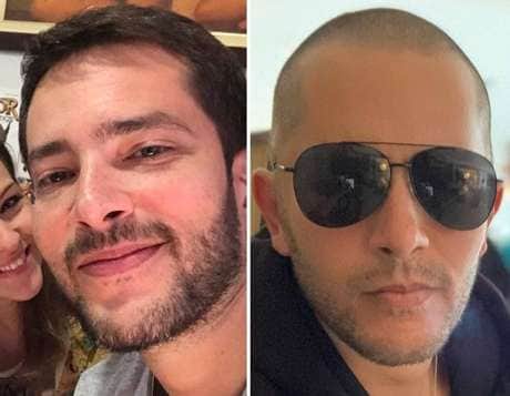 Antes e depois de Bento Ribeiro (Foto: Divulgação) Antes e depois de Bento Ribeiro (Foto: Divulgação)