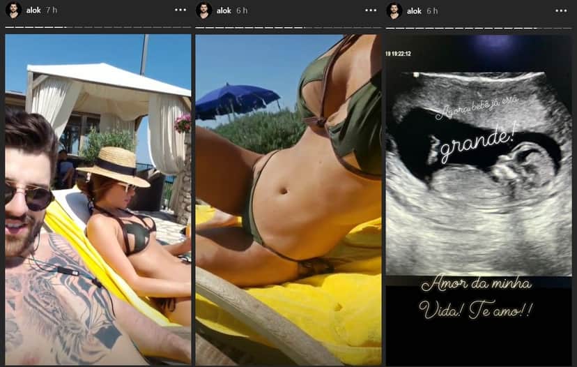 Alok mostrou para todos a barriguinha sarada de sua esposa e um ultrassom do bebê que ela espera. (Foto: Reprodução) Alok mostrou para todos a barriguinha sarada de sua esposa e um ultrassom do bebê que ela espera. (Foto: Reprodução)