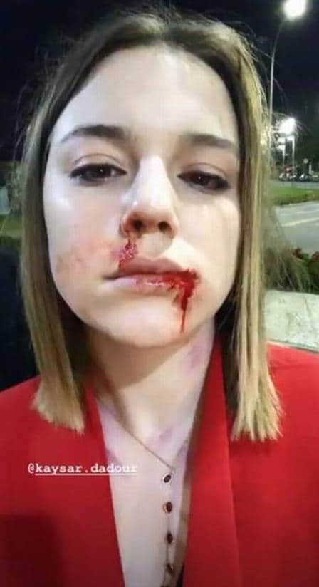 Alice Wegmann (Foto: Reprodução/ Instagram) Alice Wegmann (Foto: Reprodução/ Instagram)
