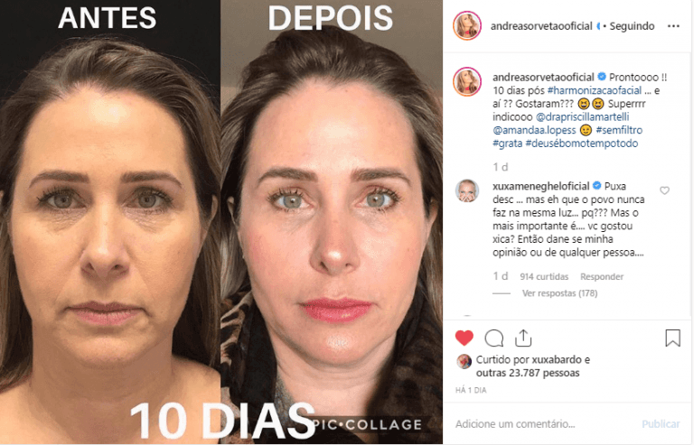 Xuxa faz novo comentário sobre visual de Andréa Sorvetão (Foto: Reprodução) Xuxa faz novo comentário sobre visual de Andréa Sorvetão (Foto: Reprodução)