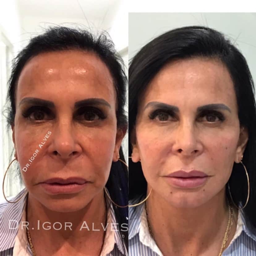 http://tvfoco.uai.com.br/wp-content/uploads/2015/05/Daniela-Mercury.jpg http://tvfoco.uai.com.br/wp-content/uploads/2015/05/Daniela-Mercury.jpg