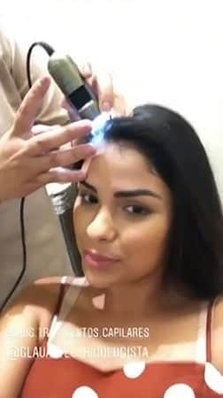 Ex- BBB Munik Nunes abre o jogo sobre agravante que surgiu após cirurgia estética (Foto: Reprodução) Ex- BBB Munik Nunes abre o jogo sobre agravante que surgiu após cirurgia estética (Foto: Reprodução)