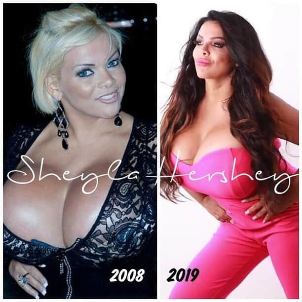 Sheyla Hershey está com câncer de mama (Foto: Reprodução/Instagram) Sheyla Hershey está com câncer de mama (Foto: Reprodução/Instagram)