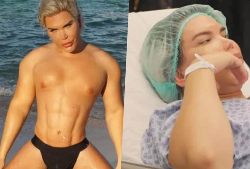 Rodrigo Alves, o Ken Humano, faz nova cirurgia (Foto: Reprodução) Rodrigo Alves, o Ken Humano, faz nova cirurgia (Foto: Reprodução)