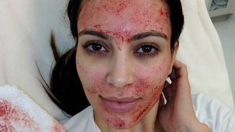 Kim Kardashian processa médico após tratamento facial (Foto: Reprodução) Kim Kardashian processa médico após tratamento facial (Foto: Reprodução)