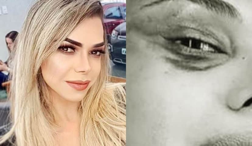 Léo Áquilla apareceu com rosto machucado e preocupou os seus fãs (Foto: Montagem/TV Foco) Léo Áquilla apareceu com rosto machucado e preocupou os seus fãs (Foto: Montagem/TV Foco)