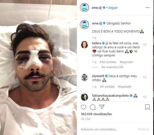 Dj Eme depois que sofreu o acidente. fica com o rosto desfigurado (Imagem: Dj Eme depois que sofreu o acidente. fica com o rosto desfigurado (Imagem: