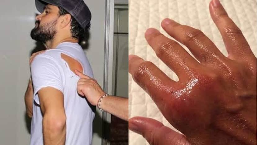 Luciano Camargo é atacado por abelha durante show e Daniela Escobar sofre com mordida de seu gato de estimação (Montagem: TV Foco) Luciano Camargo é atacado por abelha durante show e Daniela Escobar sofre com mordida de seu gato de estimação (Montagem: TV Foco)