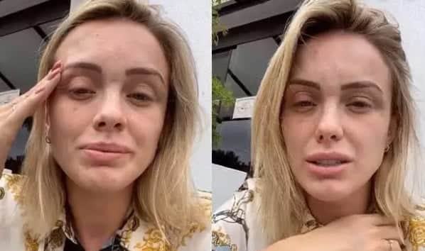 Assim como Glamour Garcia, Monick Camargo também foi vítima de agressão do companheiro Assim como Glamour Garcia, Monick Camargo também foi vítima de agressão do companheiro