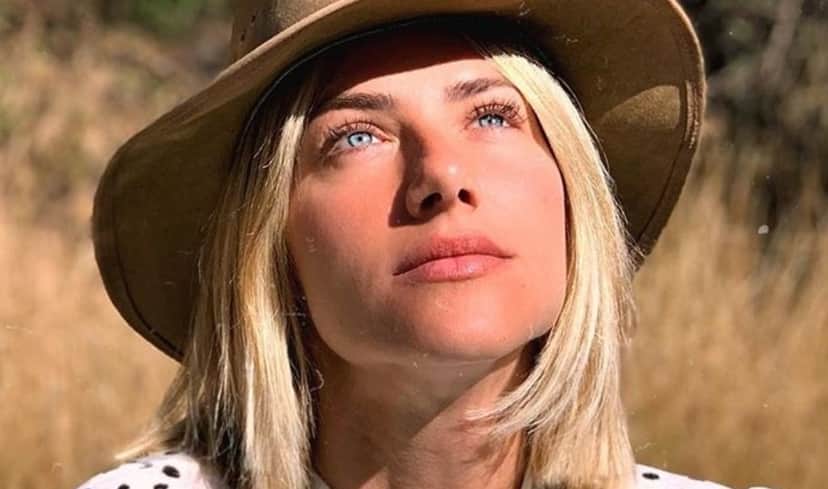 Giovanna Ewbank compartilhou foto do nariz machucado com os seus seguidores (Imagem: Reprodução) Giovanna Ewbank compartilhou foto do nariz machucado com os seus seguidores (Imagem: Reprodução)